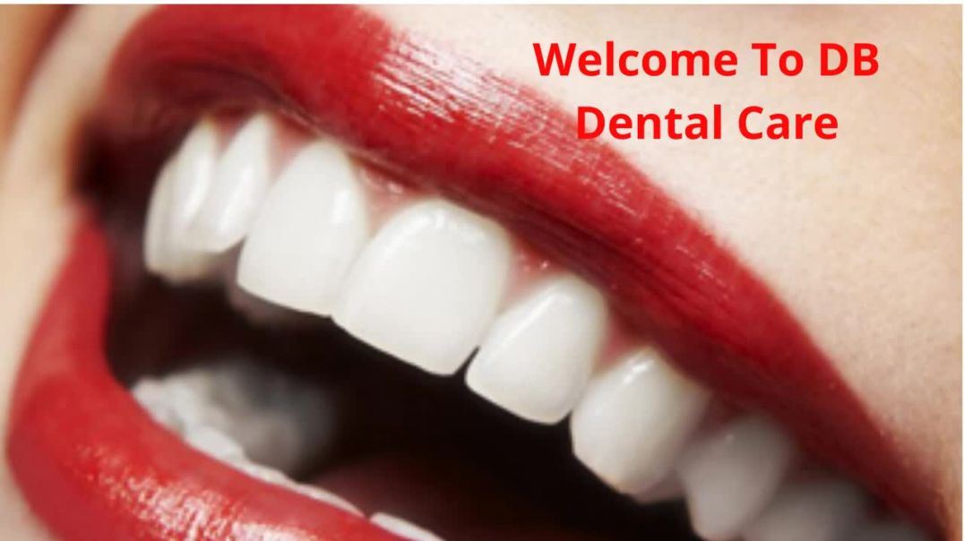 DB Dental Care : Smile Makeover in Miami, FL